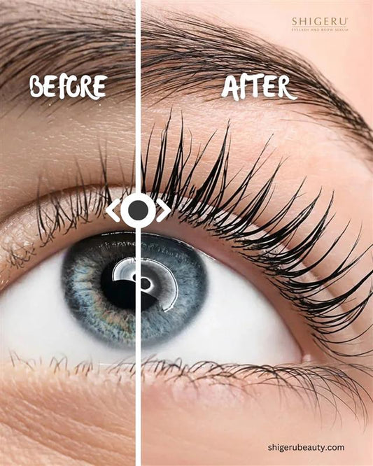 5 Signs Your Lashes Are Begging for a Growth Boost (Even with Extensions) - Shigeru Beauty